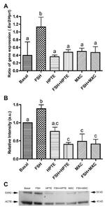 Estrogen Receptor beta Antibody in Western Blot (WB)