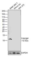TYROBP Antibody in Western Blot (WB)