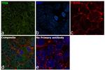 TFEB Antibody in Immunocytochemistry (ICC/IF)