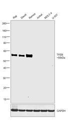 TFEB Antibody in Western Blot (WB)