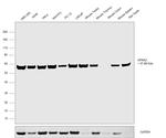 KPNA2 Antibody in Western Blot (WB)
