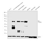 NEFL Antibody in Western Blot (WB)