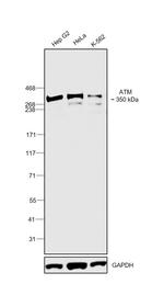 ATM Antibody in Western Blot (WB)