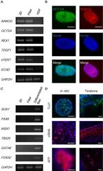 Alpha-Smooth Muscle Actin Antibody in Immunocytochemistry (ICC/IF)