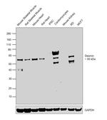 Desmin Antibody in Western Blot (WB)