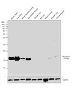 Myoglobin Antibody in Western Blot (WB)