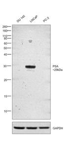 PSA Antibody in Western Blot (WB)