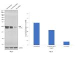 PSA Antibody in Western Blot (WB)