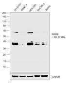 RARB Antibody in Western Blot (WB)