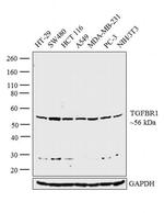 TGFBR1 Antibody in Western Blot (WB)