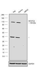NFATC2 Polyclonal Antibody