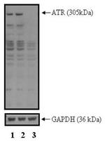ATR Polyclonal Antibody