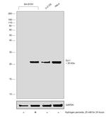 DJ-1 Antibody in Western Blot (WB)
