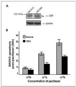 Glucocorticoid Receptor Antibody in Western Blot (WB)