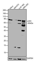 LAP2 alpha Antibody in Western Blot (WB)