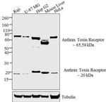 TEM8 Polyclonal Antibody