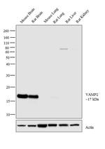 VAMP2 Polyclonal Antibody
