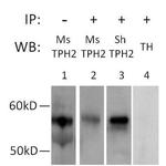TPH2 Polyclonal Antibody