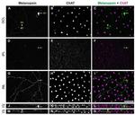 Opsin 4 Antibody in Immunohistochemistry (IHC)