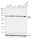 RORA Polyclonal Antibody