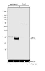 TIMP1 Antibody in Western Blot (WB)