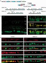 HDAC1 Antibody in Immunohistochemistry (Paraffin) (IHC (P))