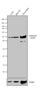 Calreticulin Polyclonal Antibody