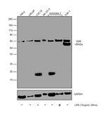 VDR Polyclonal Antibody