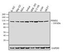 PSMD2 Antibody in Western Blot (WB)