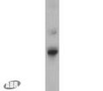 SEC61A1 Antibody in Western Blot (WB)