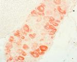 Endothelin A Receptor Antibody in Immunohistochemistry (IHC)