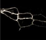 Endothelin B Receptor Antibody in Immunocytochemistry (ICC/IF)