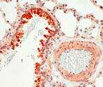 Endothelin B Receptor Antibody in Immunohistochemistry (IHC)