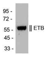 Endothelin B Receptor Antibody in Western Blot (WB)