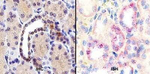 HIF1A Antibody in Immunohistochemistry (Paraffin) (IHC (P))