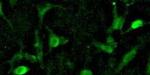 DNMT1 Antibody in Immunocytochemistry (ICC/IF)