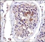 DNMT3A Antibody in Immunohistochemistry (Paraffin) (IHC (P))