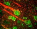 NEFM Antibody in Multiplex Immunohistochemistry (mIHC)