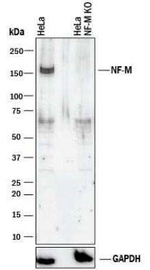 NEFM Antibody in Western Blot (WB)