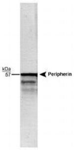 Peripherin Antibody in Western Blot (WB)