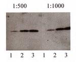 beta Amyloid (1-42) Antibody in Western Blot (WB)