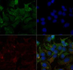 SR-BI Polyclonal Antibody