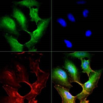 SR-BI Antibody in Immunocytochemistry (ICC/IF)