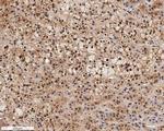 SR-BI Antibody in Immunohistochemistry (Paraffin) (IHC (P))