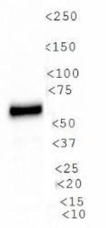 PDZK1 Antibody in Western Blot (WB)