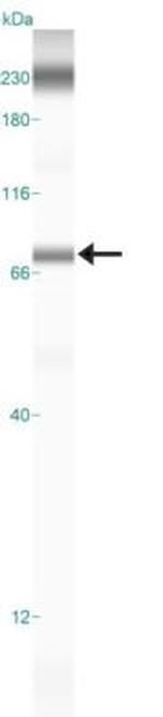 PDZK1 Antibody in Western Blot (WB)