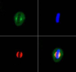 KIF2A Antibody in Immunocytochemistry (ICC/IF)