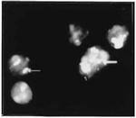 Nucleolin Antibody in Immunocytochemistry (ICC/IF)