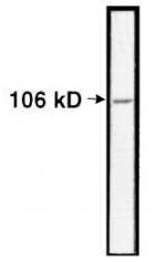Nucleolin Antibody in Western Blot (WB)