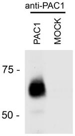 PACAP Receptor Antibody in Western Blot (WB)